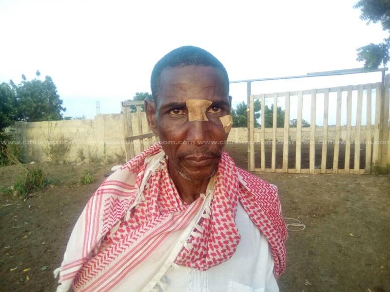 One of the brutalized victims of the robbery