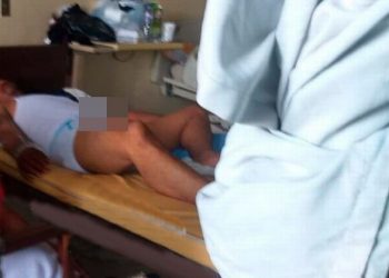 The man had to have surgery in hospital