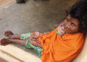 Woman with record breaking 31 fingers and toes branded 'witch'