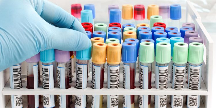 blood tests