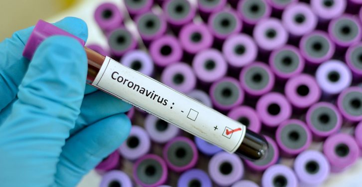 Coronavirus positive