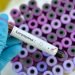 Coronavirus positive