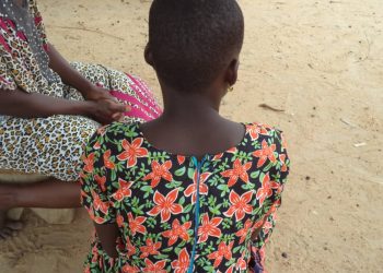 FGM victim