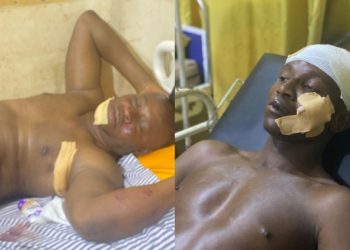 Some of the injured police officers