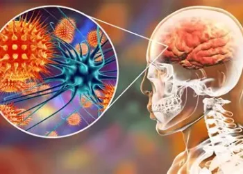 meningitis