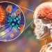 meningitis